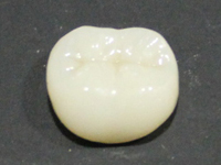 セラミック製の人工歯
